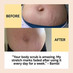 
                    
                      BodyScrubBeforeandAfterComplexion_2b9a7038-d37e-43b7-8c92-7d00adae4162 - Miracle Tree
                    
                  